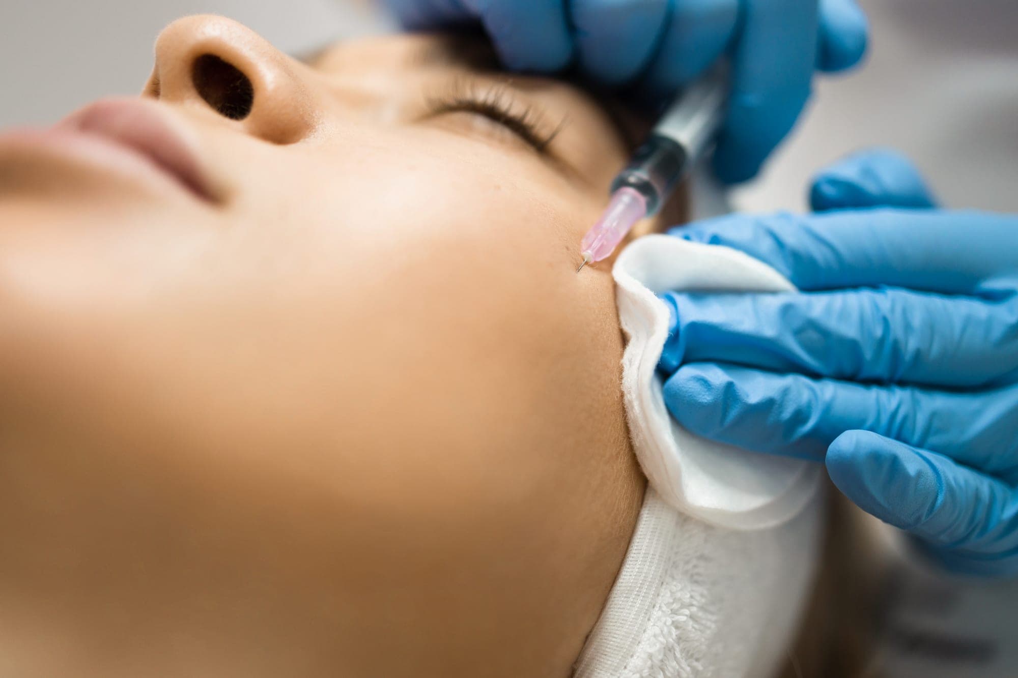 Mesotherapy at Renewa Clinic