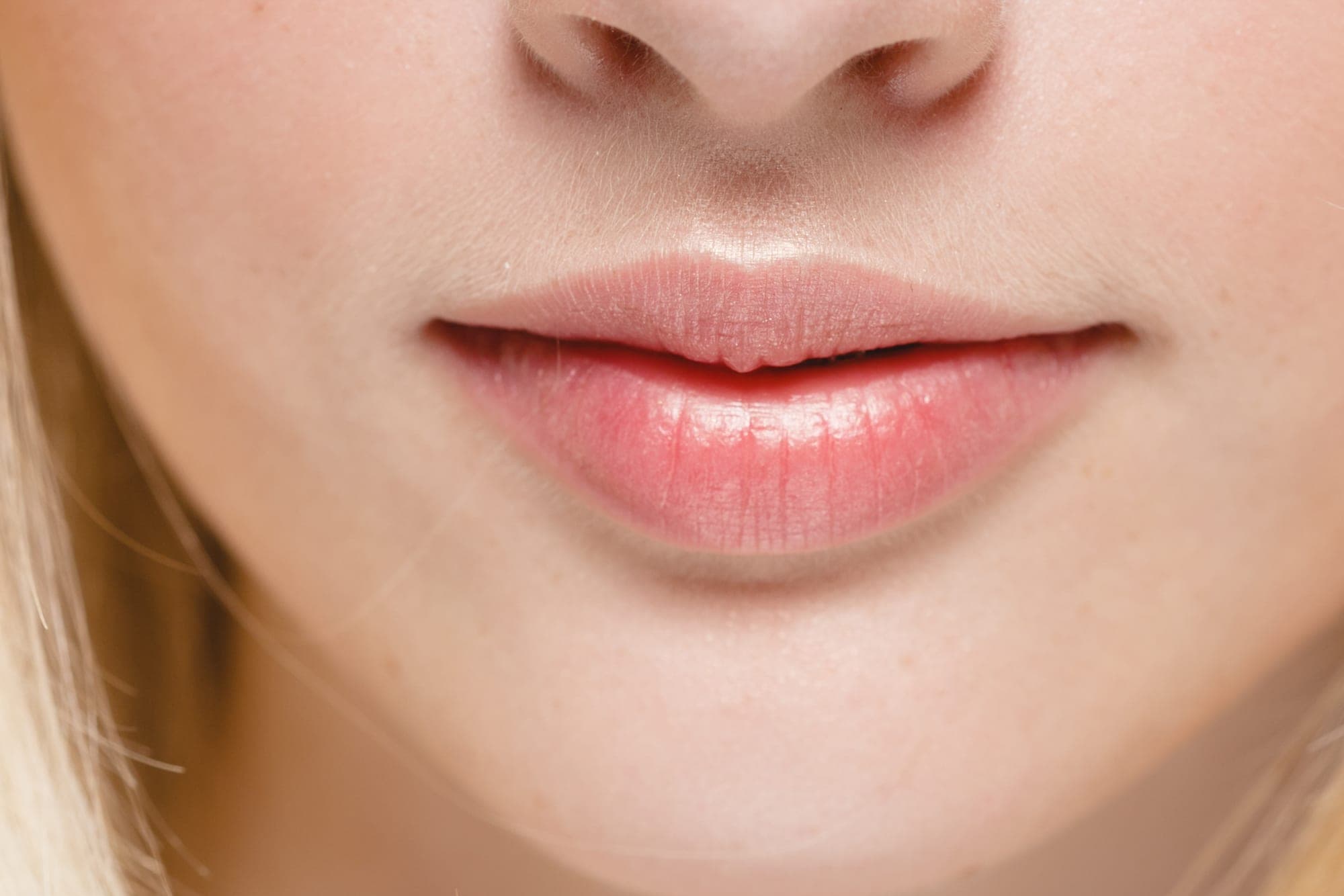 Lip reduction at Renewa Clinic