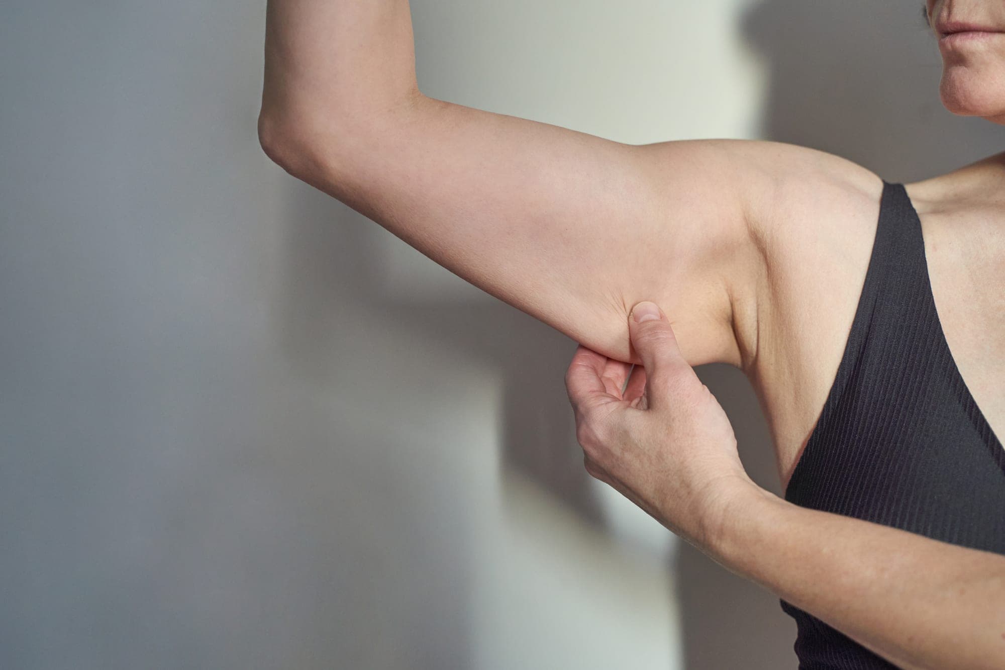 Arm lift at Renewa Clinic