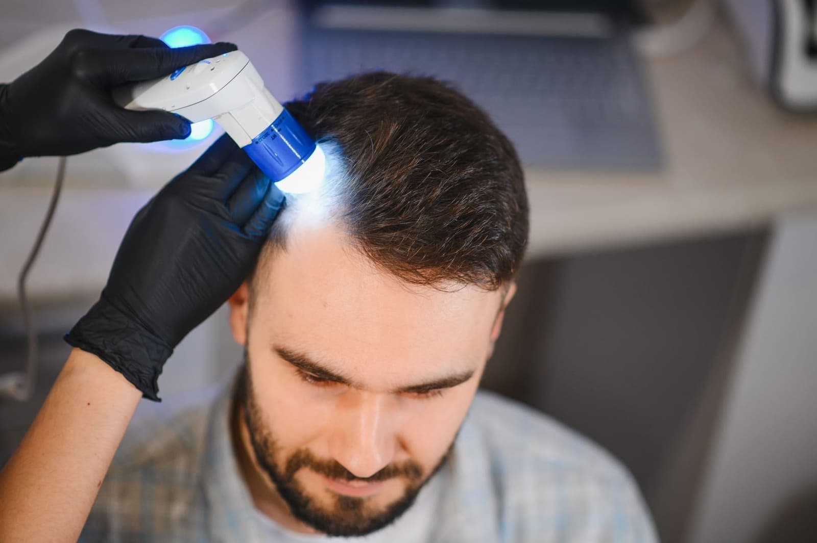 Hair Transplantation at Renewa Clinic