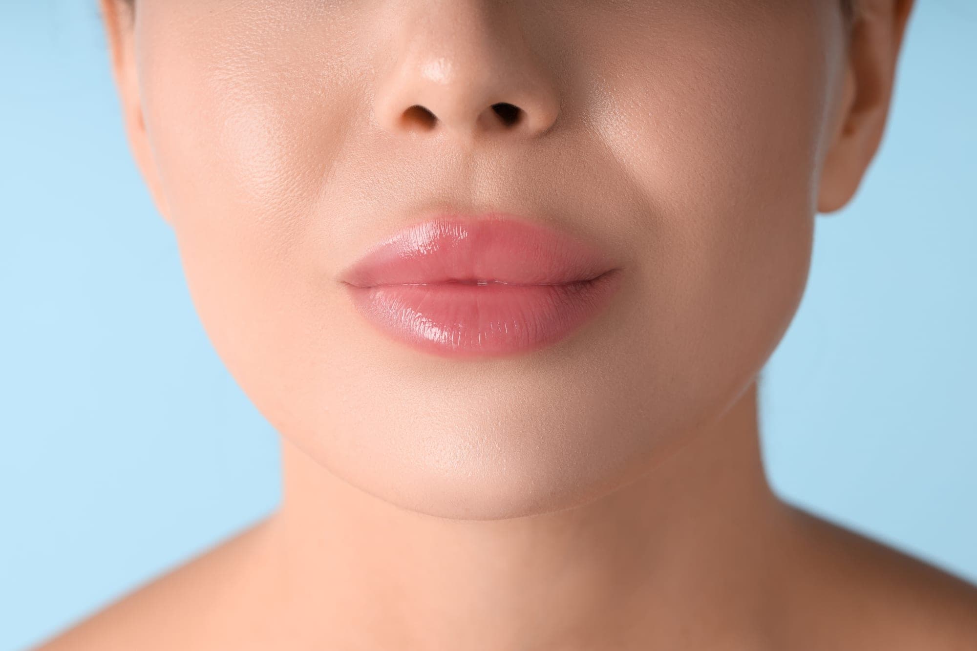 Lip lift at Renewa Clinic