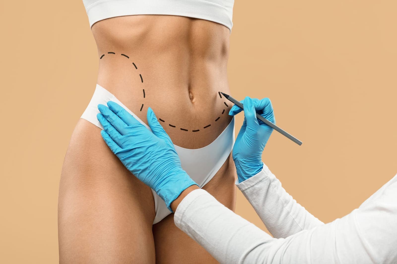 Tummy Tuck at Renewa Clinic